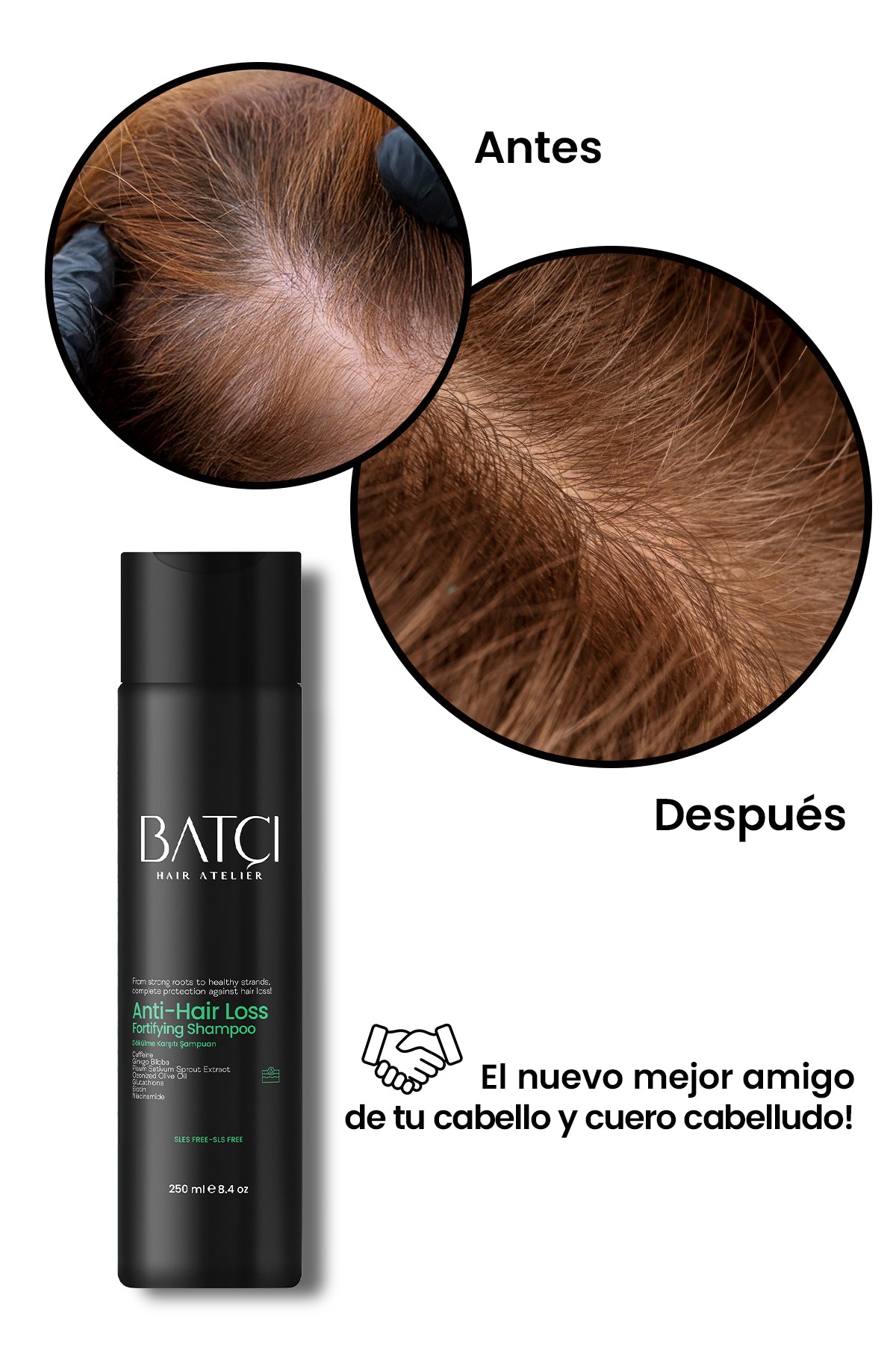 Champú Anticaída 250 ml - Fórmula Voluminizadora y Nutritiva con Ginkgo Biloba y Glutatión