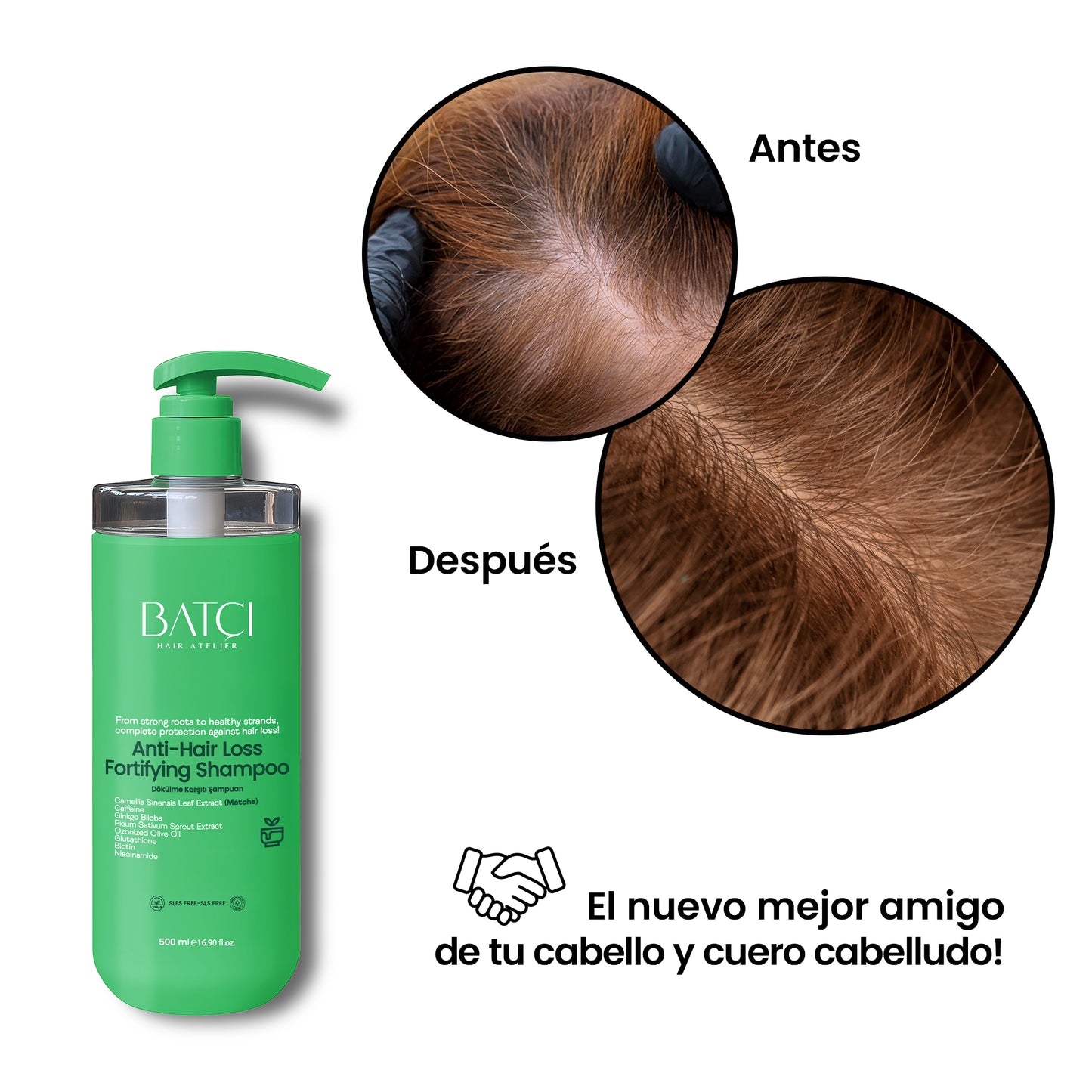 Champú Anticaída 500 ml - Fórmula Voluminizadora y Nutritiva con Ginkgo Biloba y Glutatión
