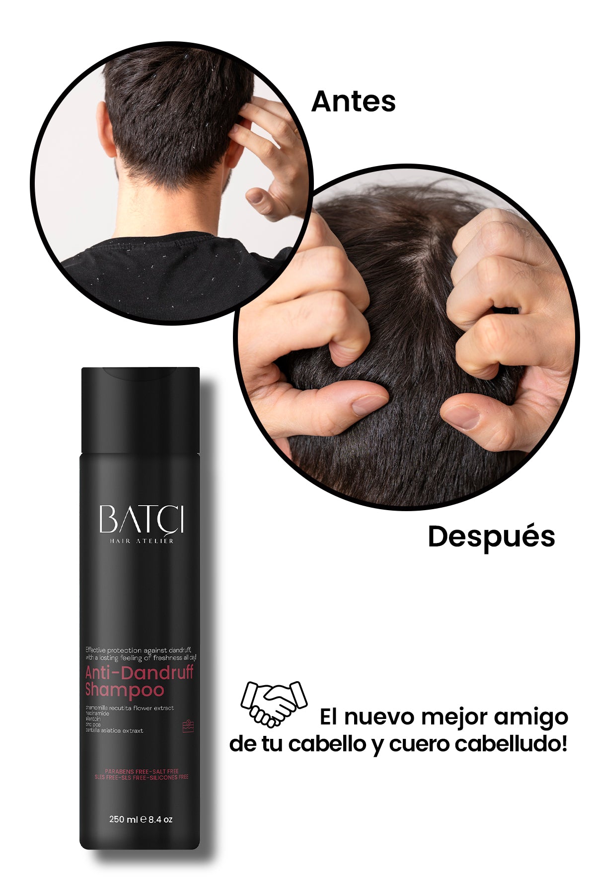 Champú Anticaspa 250 ml - Fórmula Nutritiva con Extracto de Flor de Manzanilla & Vitamina B3