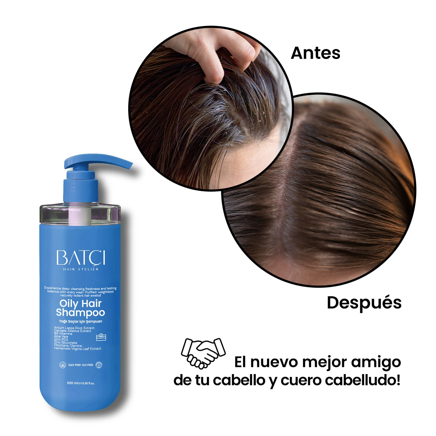 Champú Antigrasa 500 ML